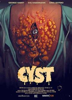 ცისტა / Cyst